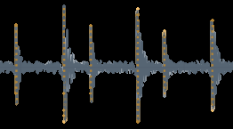 图2: 不同模型生成的心音波形定性比较