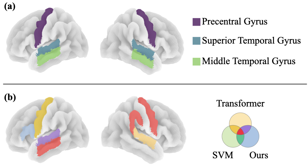 全脑MVPA结果可视化