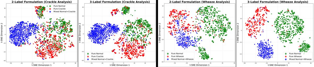图3: Precision-Recall Curves for the three classes (Normal, Crackle, Wheeze) on the ICBHI test set.