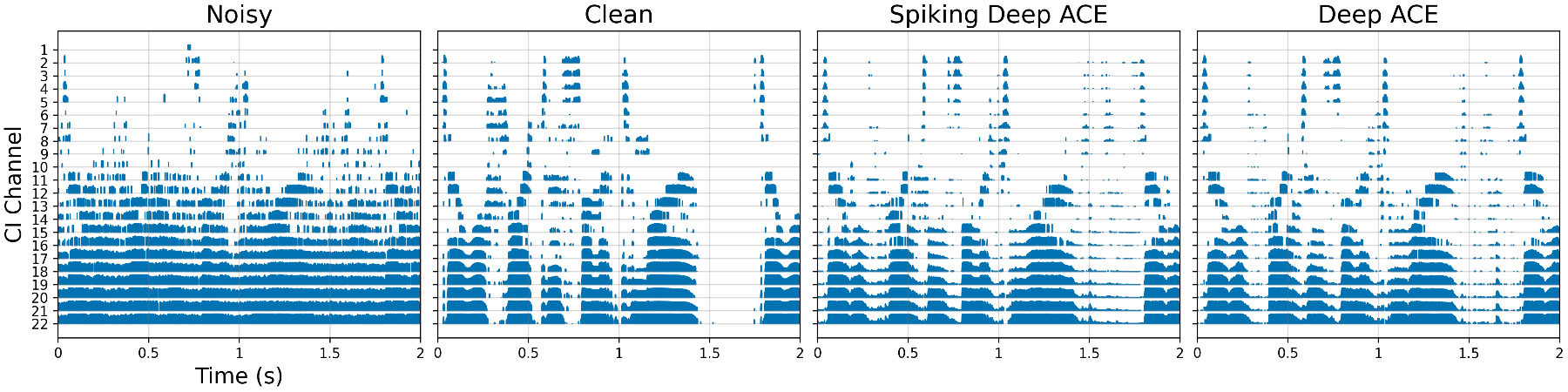 原论文 Figure 2:Example of predicted electrodograms by each of the models as well as the clean and noisy…