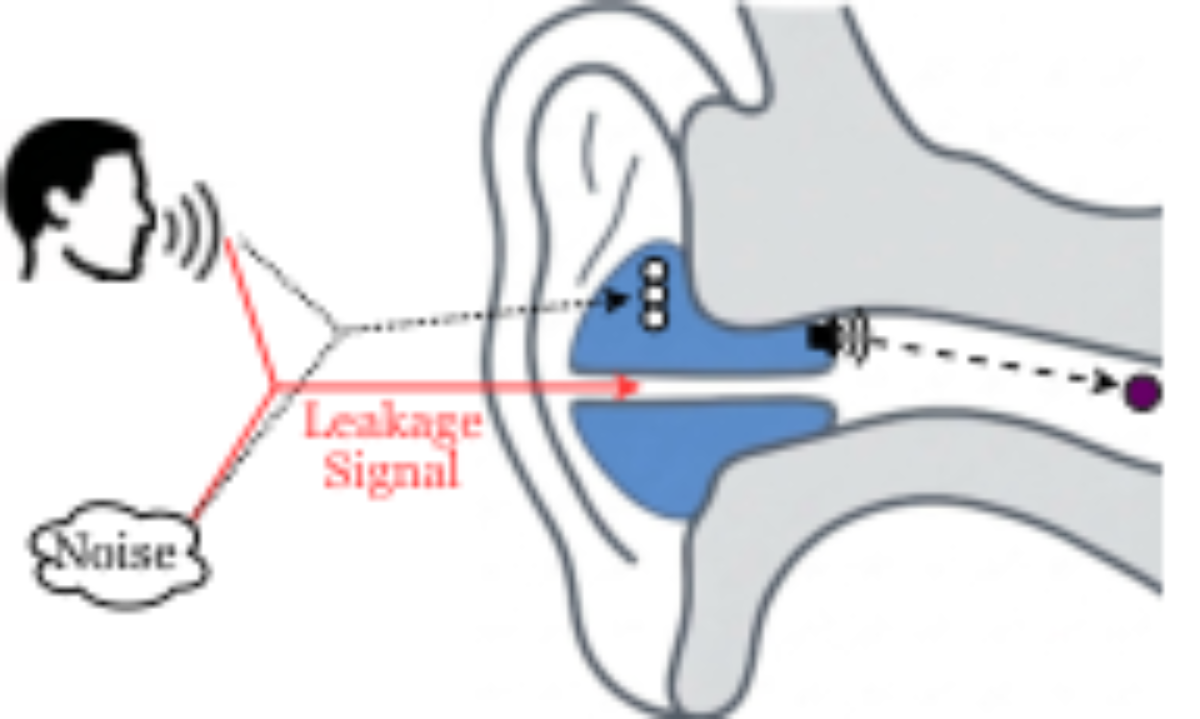 原论文 Figure 1：Acoustic leakage in semi-open-fit HAs.