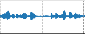 Application of MultiDiffusion in speech separation